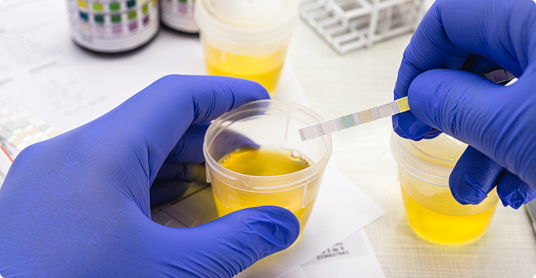 Image representing Catheterization (Indwelling Urinary Catheter)